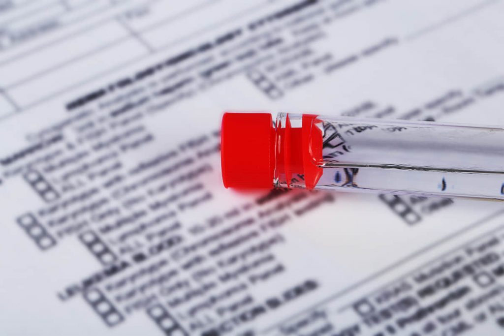 REACH Kimyasalların Tescili, Değerlendirilmesi ve Yetkilendirilmesi - G&uuml;venlik Bilgi Formu, Sınıflandırma ve Etiketleme